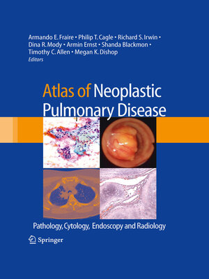 cover image of Atlas of Neoplastic Pulmonary Disease